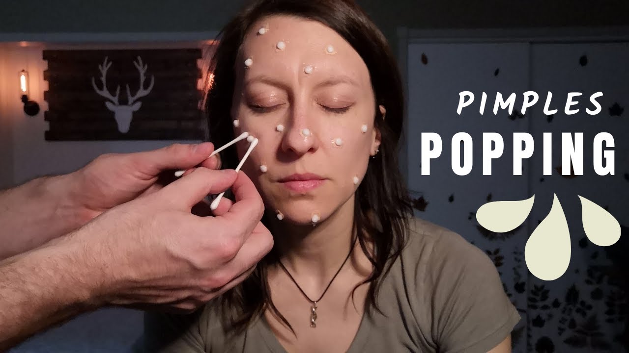 Real Person ASMR Giant Pimple Popping, No-Talking