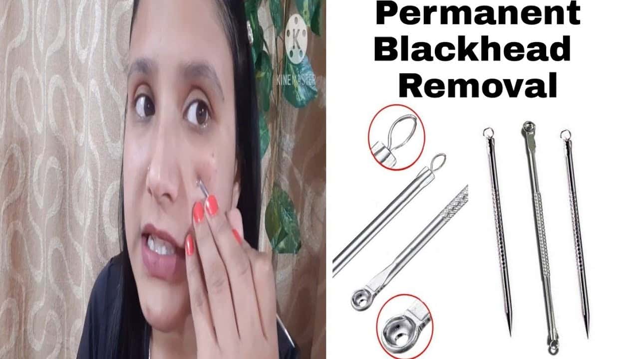 Remove Permanently BlackHeads at Home Using Stainless Steel Blackheads Remover Needles ||
