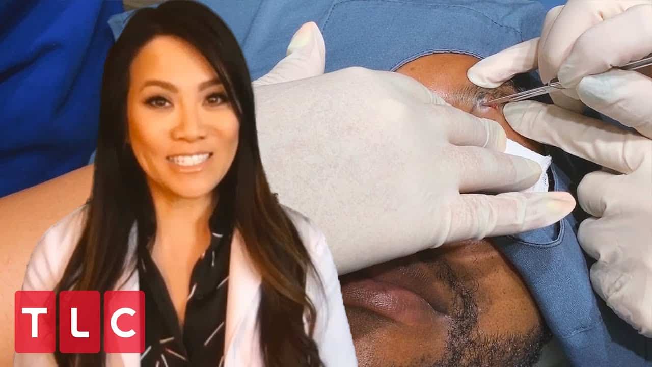 Removing Patient's "Third Eyeball" | Dr. Pimple Popper: This is Zit