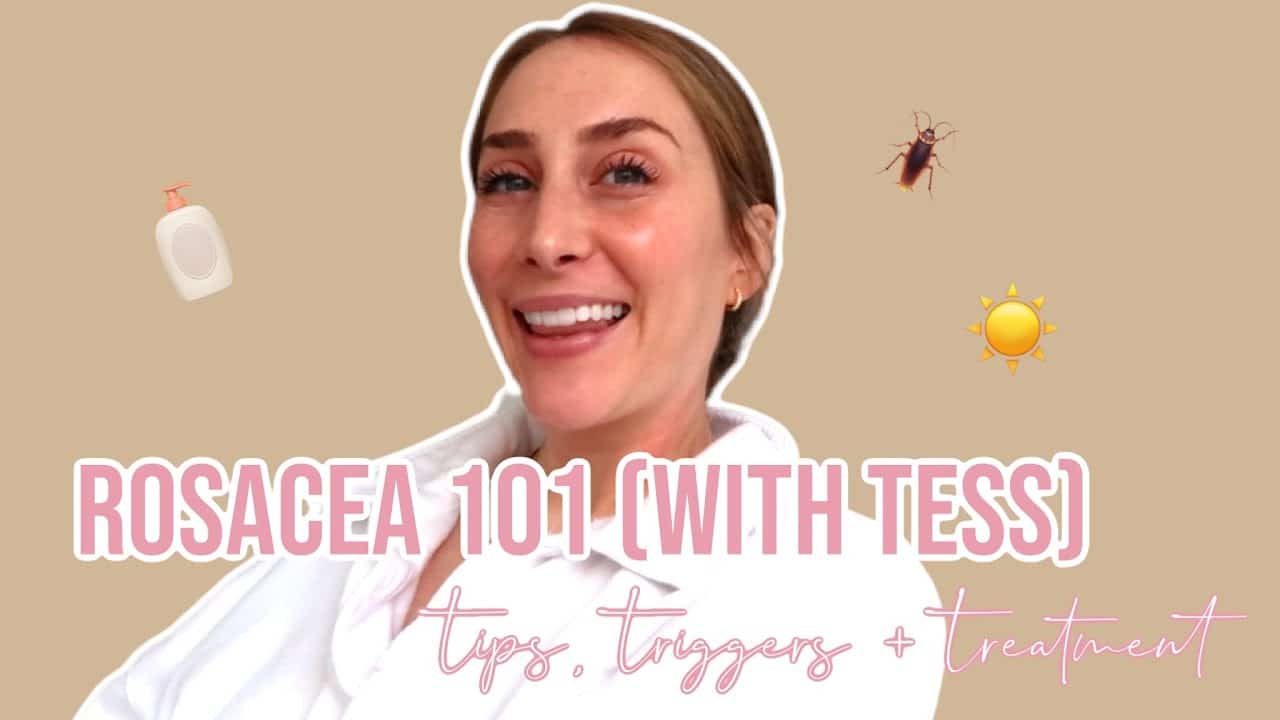 ROSACEA 101: Tips, Triggers + Treatments from an Esthetician + Expert.