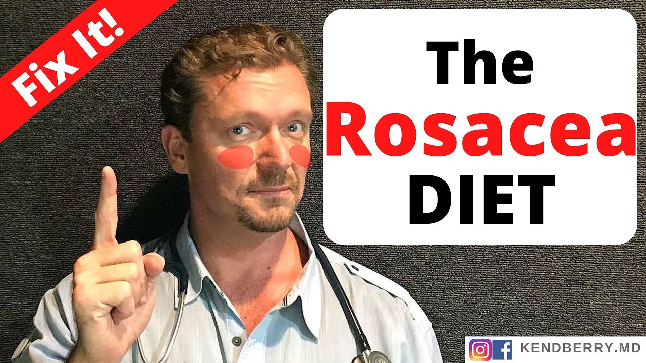 ROSACEA diet (Reverse the Redness) 2021