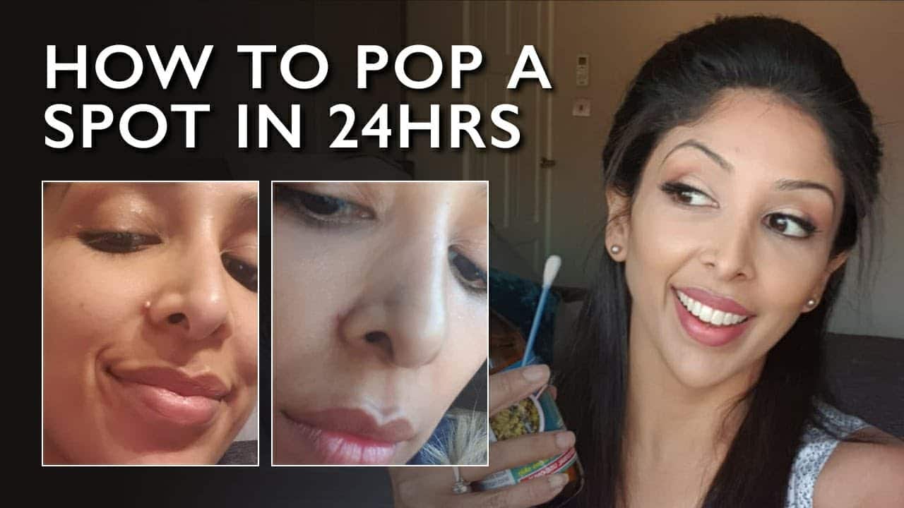 SAFELY Pop a Spot  by DOCTOR Brown/ Dark skin | Pop a spot | DR Pimple Popper |DR V acne treatment