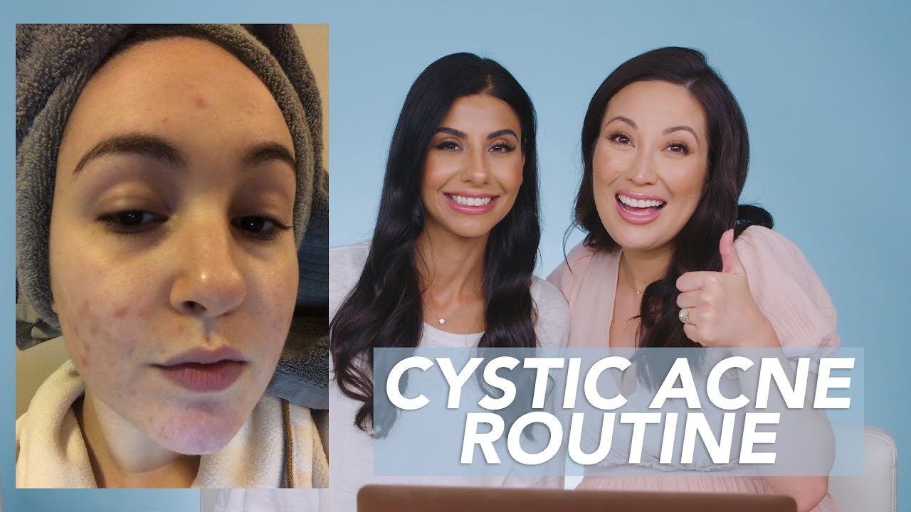 Sensitive Skin and Cystic Acne Skincare Routine for Danielle!