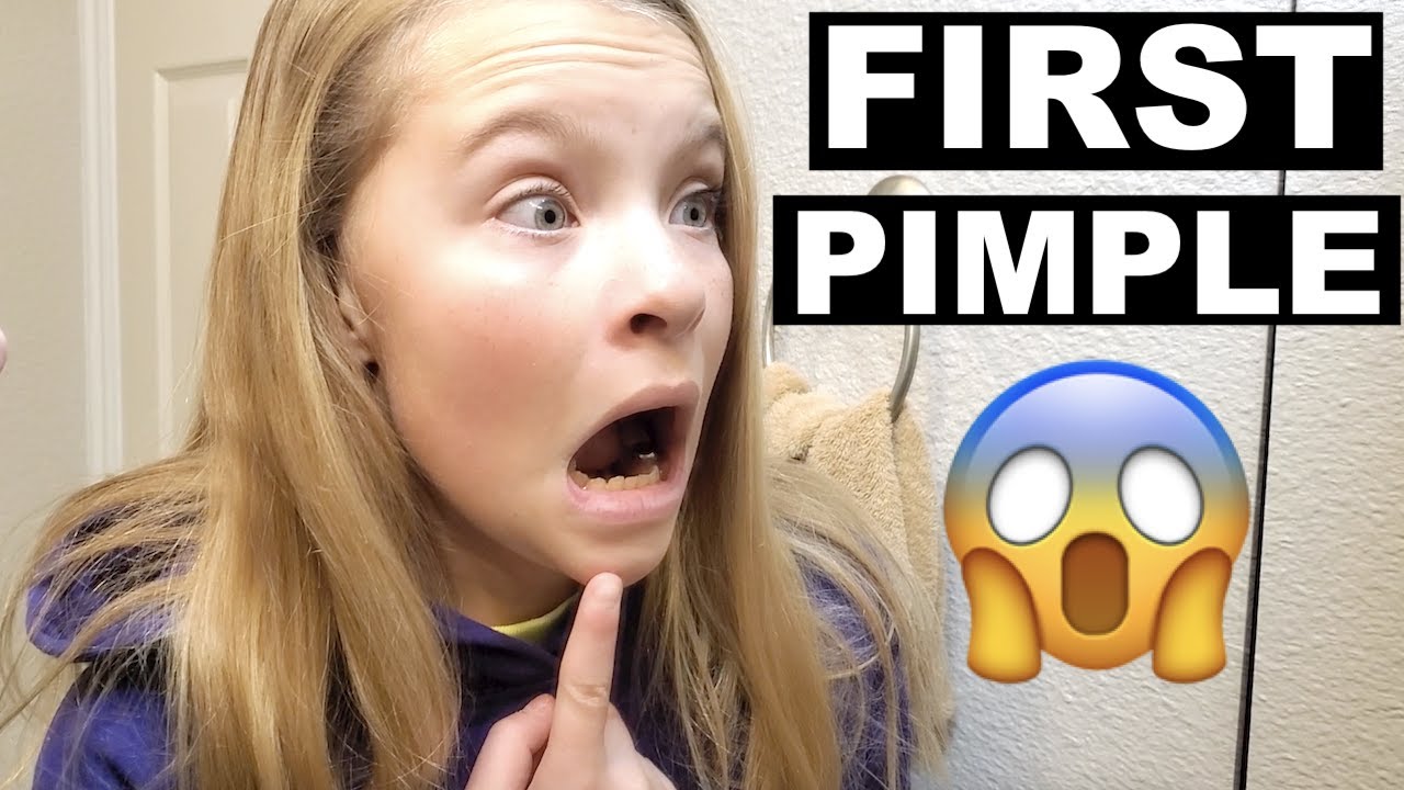 SHE POPPED HER FIRST PIMPLE!