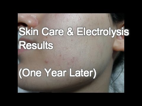 Skin Care & Electrolysis Results – One Year later