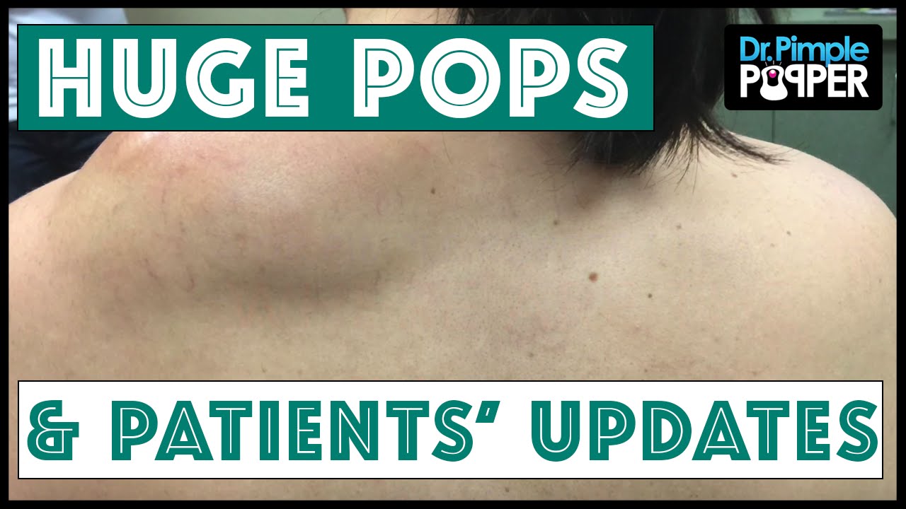 Some HUGE Past Pops and Updates!!