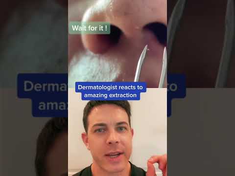 Super satisfying blackhead extraction | 208SkinDoc Dermatologist pimple popping