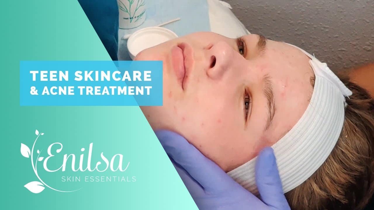 Teen Skincare & Acne Treatment (Educational Video)