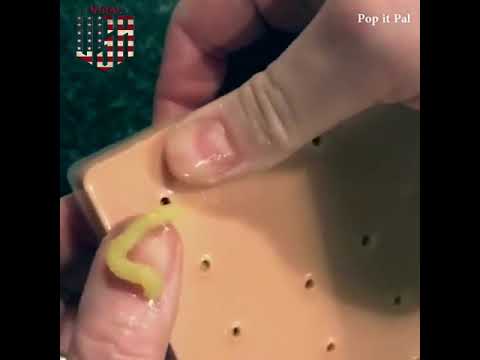 The Best Pimple Popping Toy