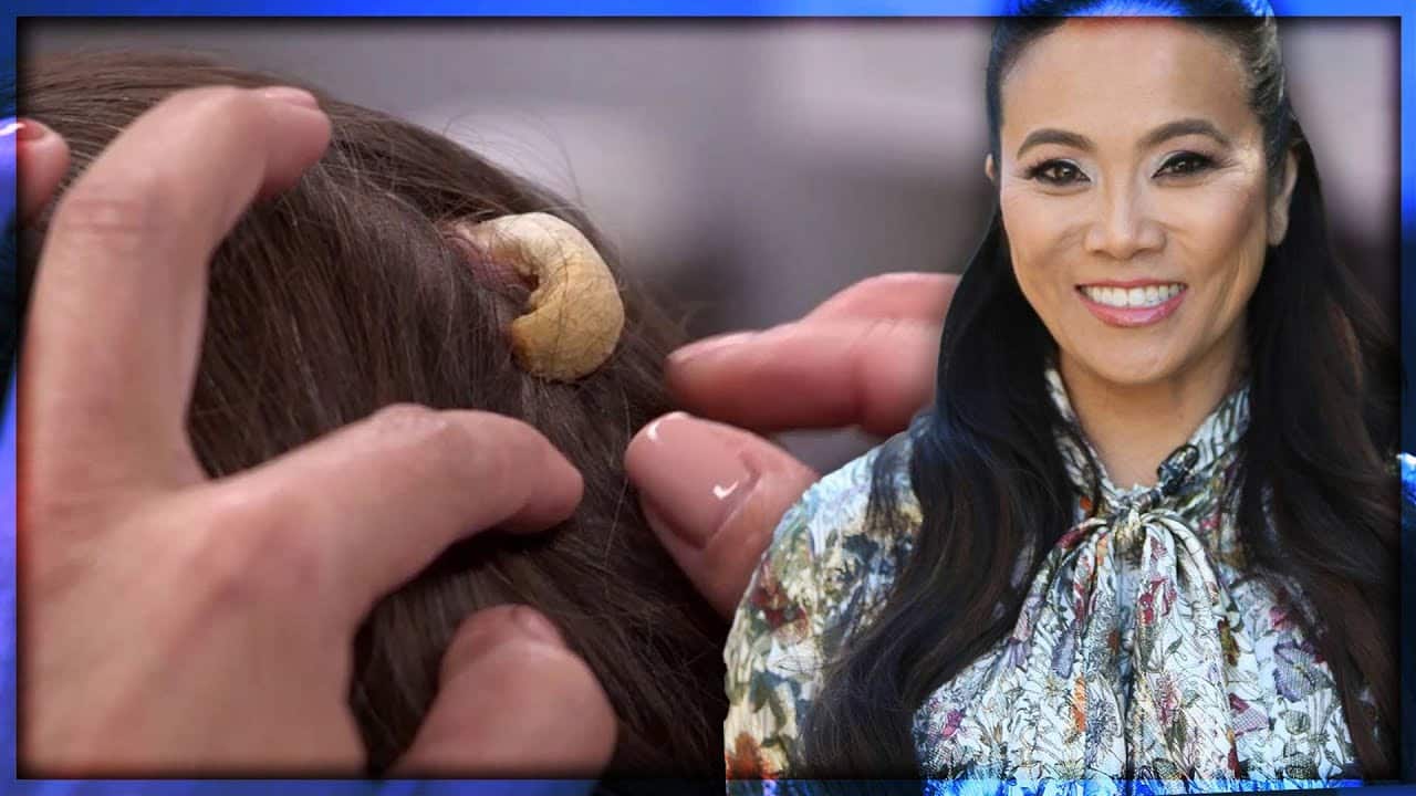 The Biggest Removals EVER on Dr. Pimple Popper!🤮