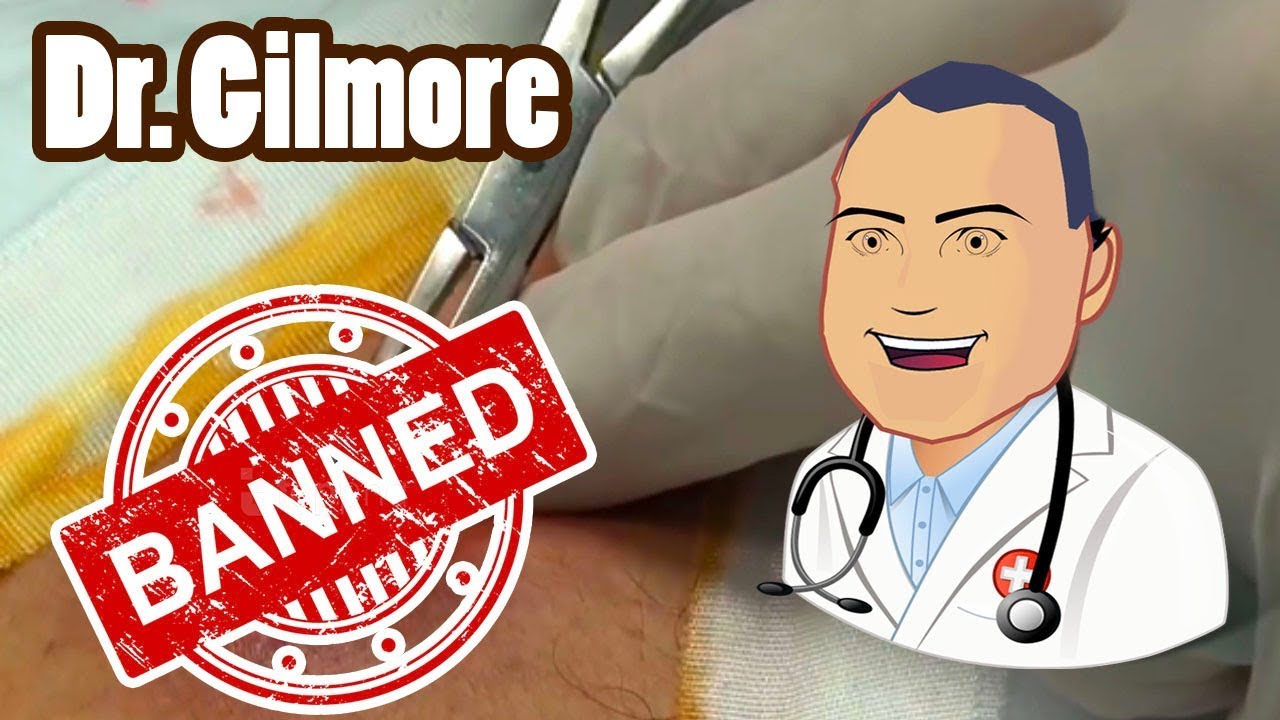 The @bsce$$ YouTube Wants to Ban!  Dr. Gilmore