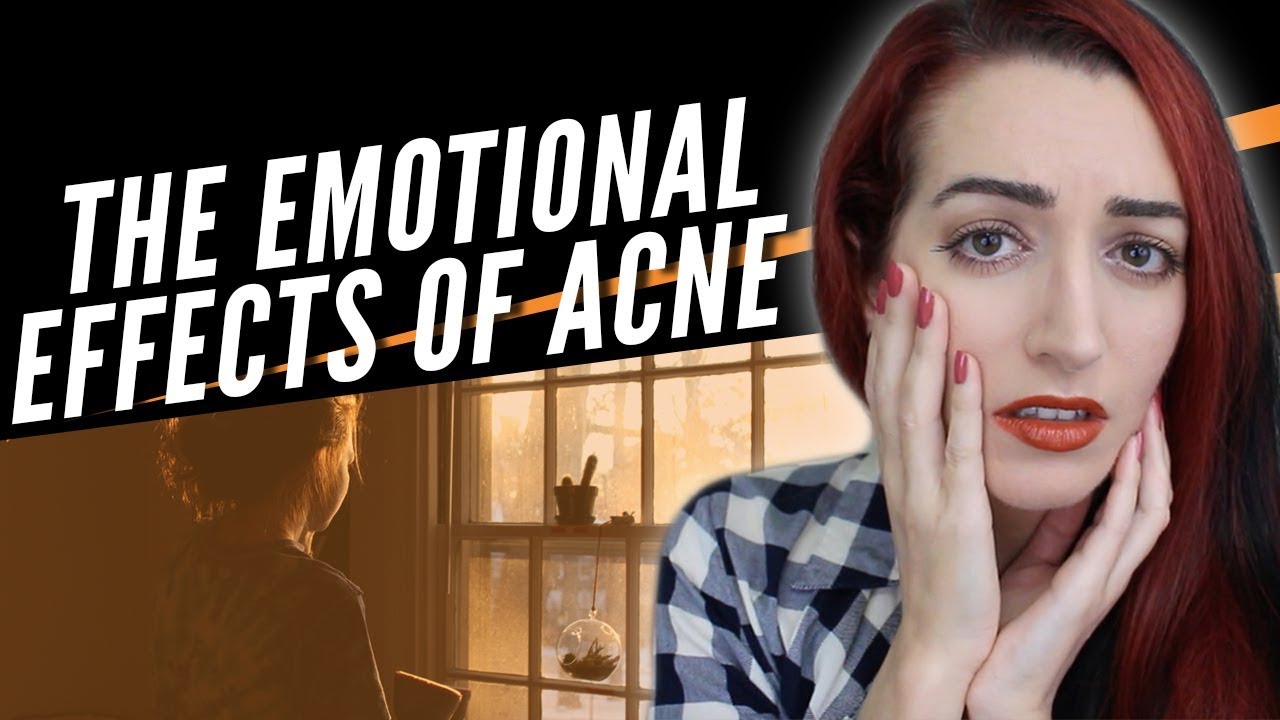 The Emotional Effects Of Acne