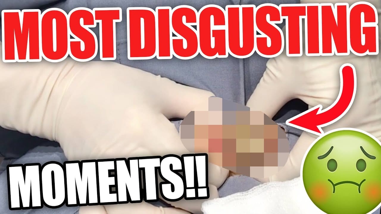 The GROSSEST and MOST DISGUSTING Moments on Dr. Pimple Popper! (Part 5)