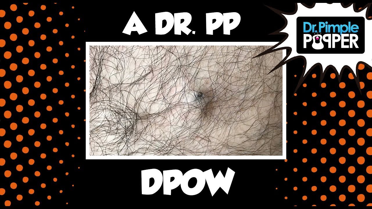 The Jungle Is Dark, but Full of Diamonds… A Dr Pimple Popper DPOW