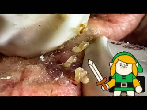 The Legend of Zelda's Pimple!  Pimple Popping