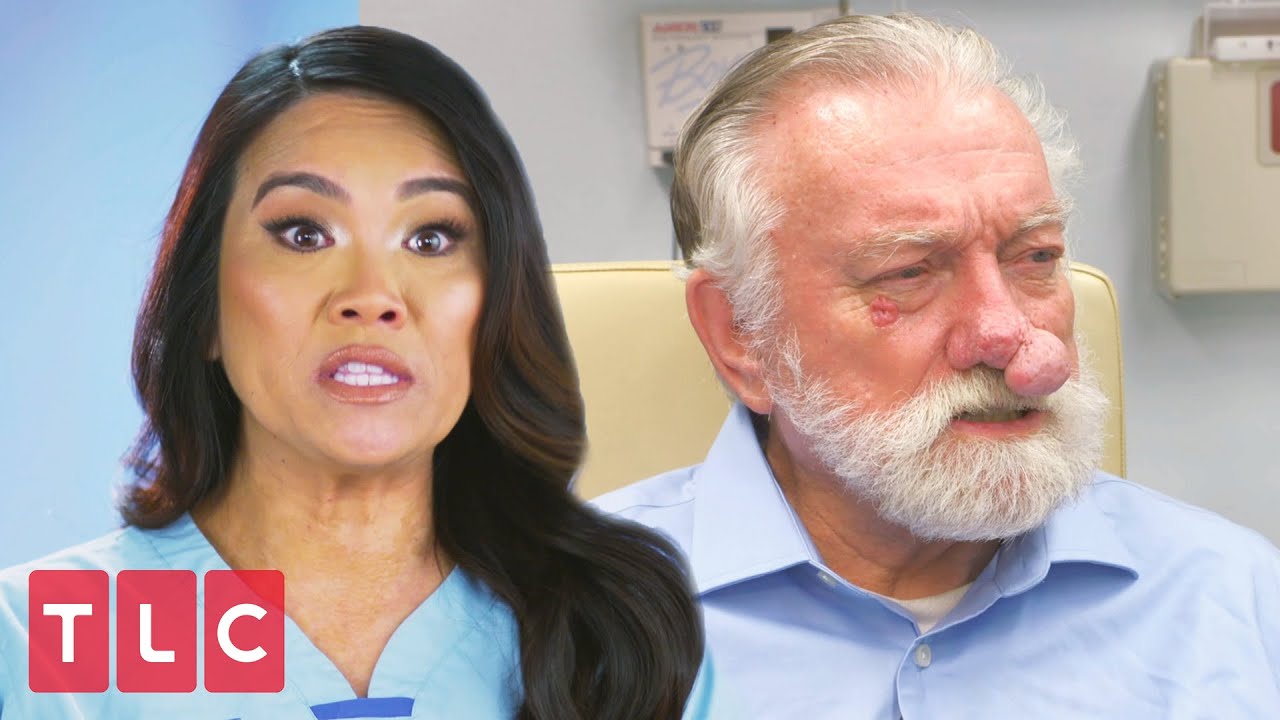 The Man With "Two Noses" | Dr. Pimple Popper