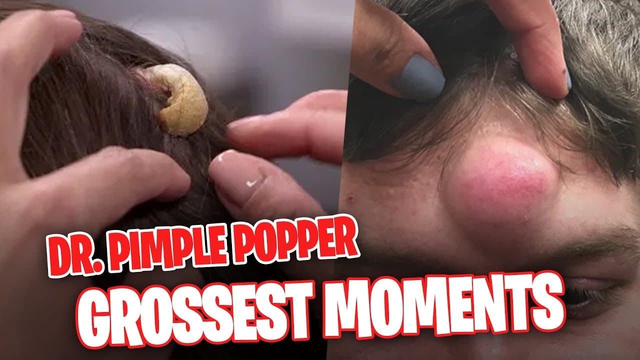 The MOST DISGUSTING Moments from Dr. Pimple Popper that made us ABSOLUTELY SHUDDER! (Part 20)