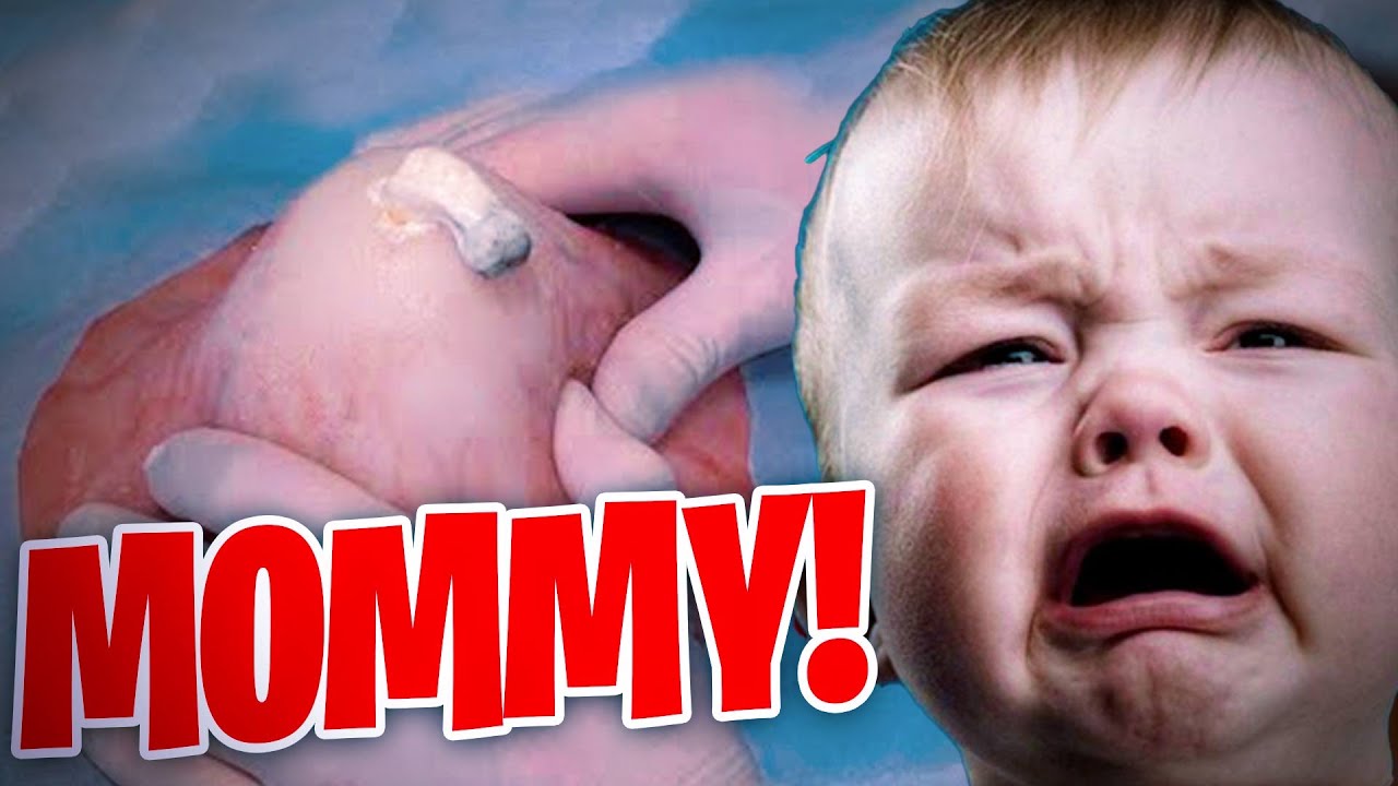 The MOST DISGUSTING Pimple Popping Moments 2020 (PART 1)