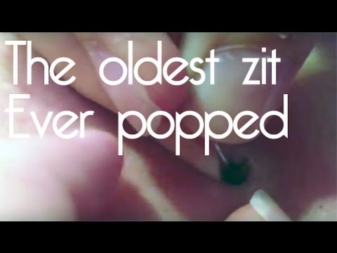 The oldest zit ever popped
