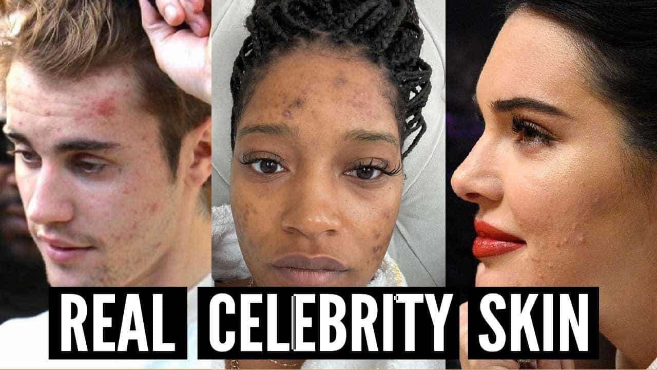 The Truth and Reality of Celebrity Skin Texture