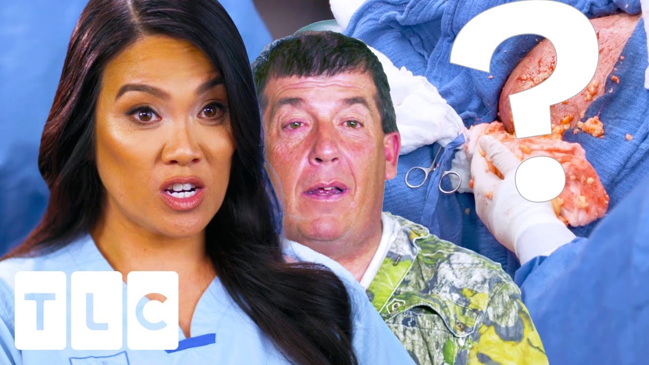 “This Thing Has Woken Up”: The MESSIEST Extraction Of All Time | Dr. Pimple Popper