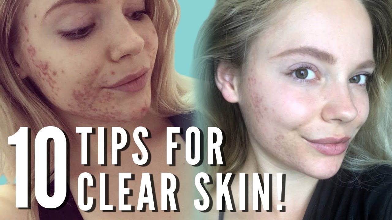Top 10 Tips For Clear Skin