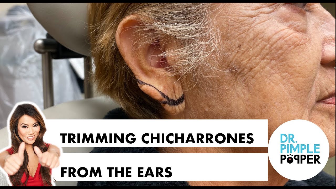 Trimming Chicharrones from the Ear