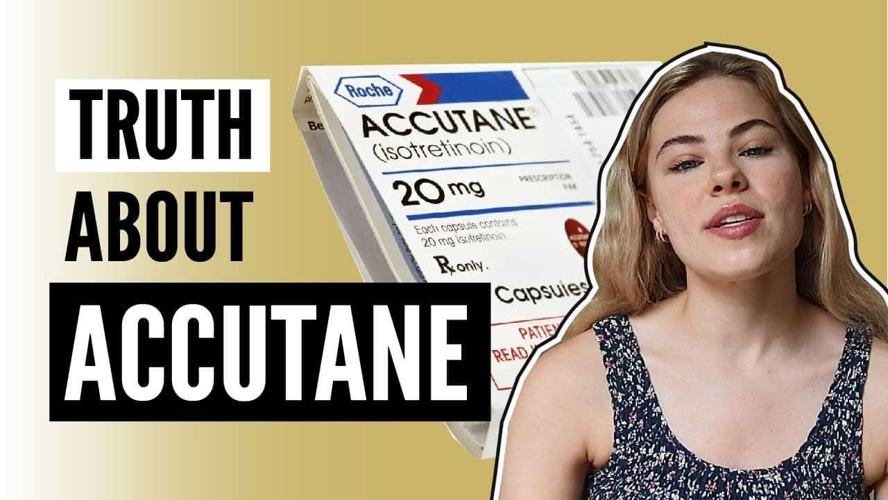 Truth About Accutane | NEED TO KNOWS BEFORE TAKING IT