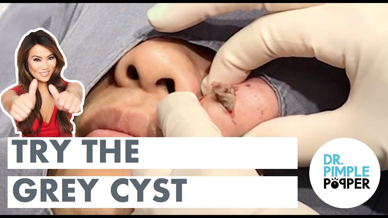 Try the Grey Cyst