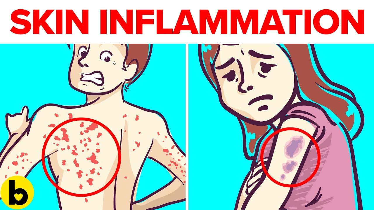 Warning Signs & Symptoms Of Skin Inflammation
