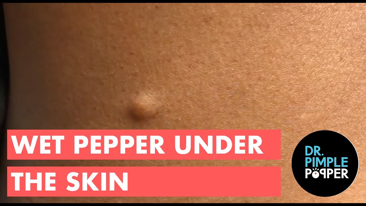 Wet Pepper Under the Skin
