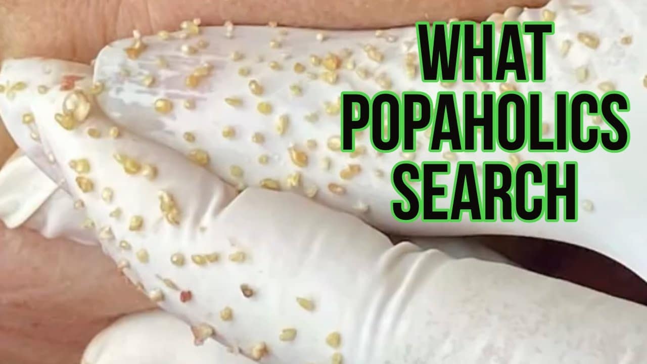 What Are Popaholics Searching The Most?! Top Ten Pimple Popping and Dermatology Search Terms