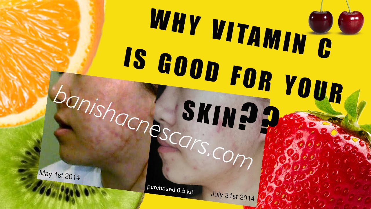 WHAT IS VITAMIN C AND HOW DOES IT WORK FOR YOUR SKIN? DML style