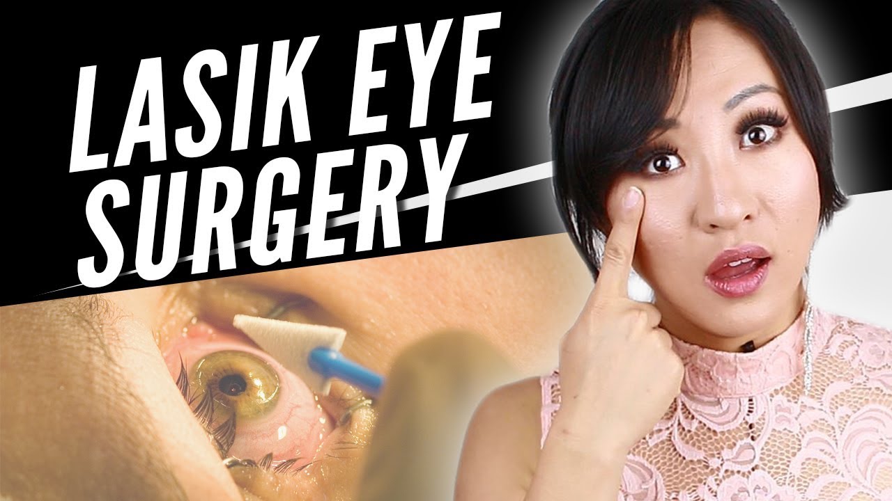 What To Know Before Getting Lasik