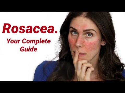 Why Does Everyone Get Rosacea Wrong? What It Is and How to Treat It