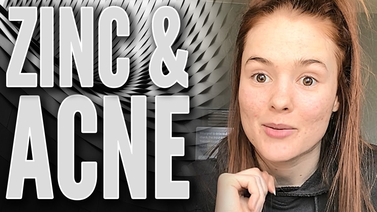 Why Everyone With Acne Should Try Zinc – Natural Treatment for Acne!