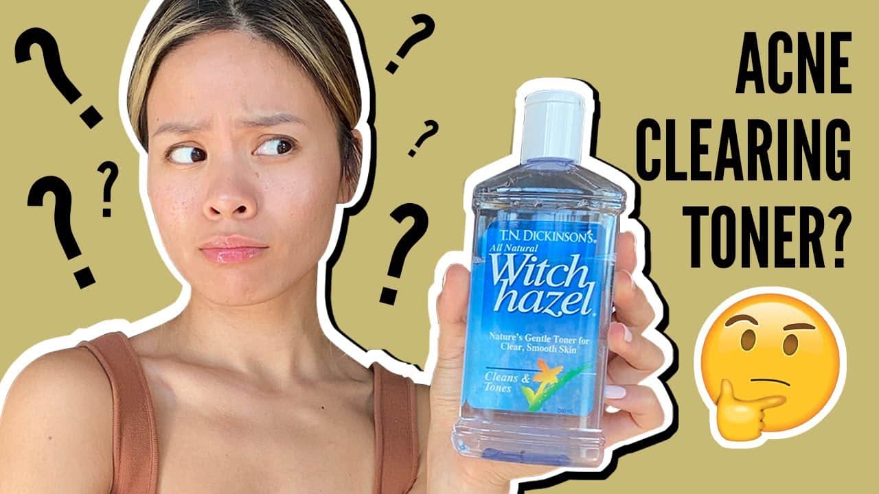 Witch Hazel for Acne : Good Or Bad? Get The Facts