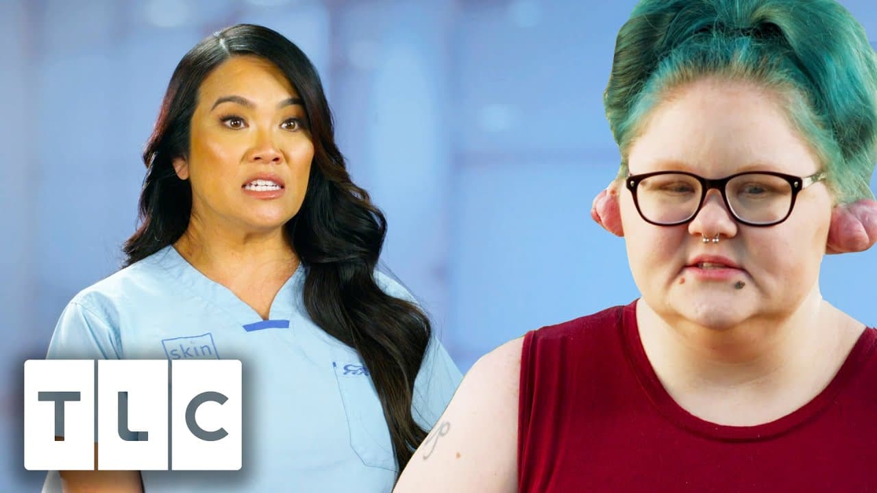 Woman Has Been Living With Keloids For 11 Years | Dr. Pimple Popper Pop Ups