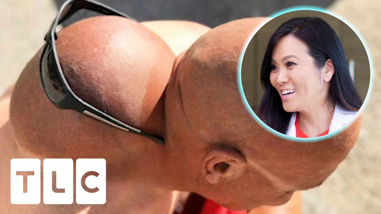 "You Have Got A Head Behind Your Head!" | Dr. Pimple Popper: Before The Pop