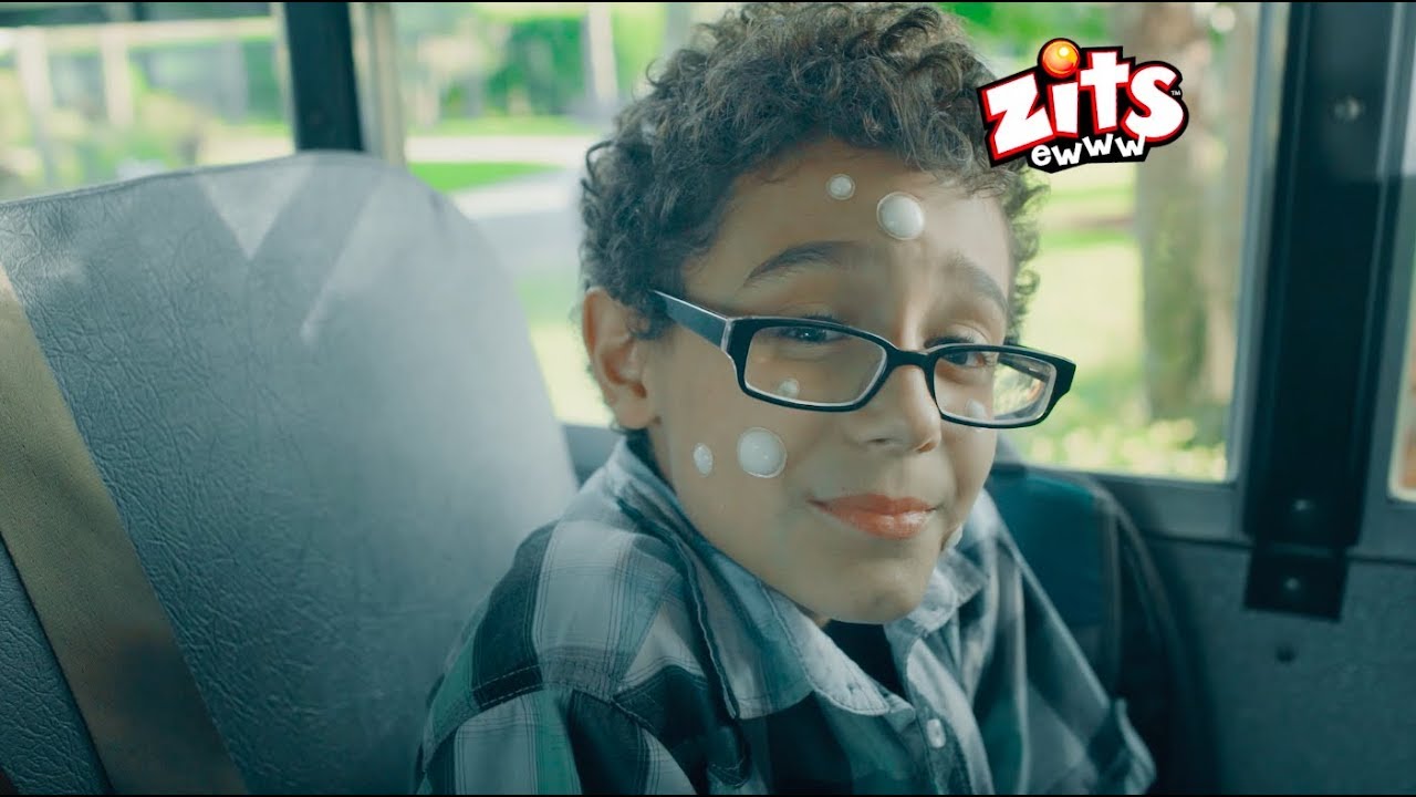 Zits Pop n Play Pimples Toy Commercial – I Got Zits – Kids on Bus :15 2018