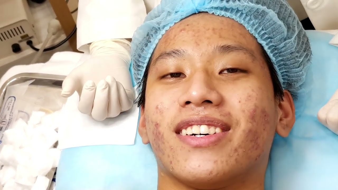 Dr Pimple Popper Explains Forehead Growth Pimple Popping Videos